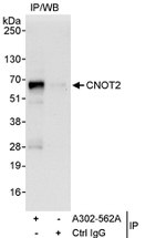 CNOT2 Antibody in Immunoprecipitation (IP)