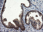 CNOT4 Antibody in Immunohistochemistry (Paraffin) (IHC (P))