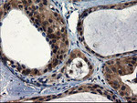 CNOT4 Antibody in Immunohistochemistry (Paraffin) (IHC (P))