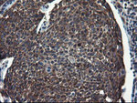 CNOT4 Antibody in Immunohistochemistry (Paraffin) (IHC (P))