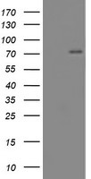 CNOT4 Antibody in Western Blot (WB)