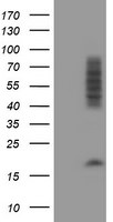 CNOT4 Antibody in Western Blot (WB)