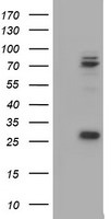 CNOT4 Antibody in Western Blot (WB)