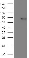 COASY Antibody in Western Blot (WB)