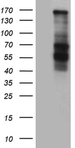 COL3A1 Antibody in Western Blot (WB)