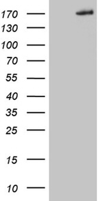 COL5A2 Antibody in Western Blot (WB)