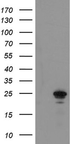 COMMD1 Antibody in Western Blot (WB)