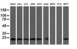 COMMD1 Antibody in Western Blot (WB)