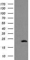 COMMD1 Antibody in Western Blot (WB)