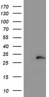 COMMD1 Antibody in Western Blot (WB)