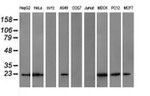 COMMD1 Antibody in Western Blot (WB)