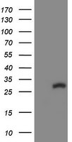 COMMD1 Antibody in Western Blot (WB)