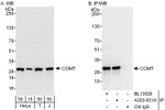 COMT Antibody in Western Blot (WB)