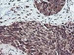 COPS5 Antibody in Immunohistochemistry (Paraffin) (IHC (P))