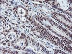 COPS5 Antibody in Immunohistochemistry (Paraffin) (IHC (P))