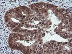 COPS5 Antibody in Immunohistochemistry (Paraffin) (IHC (P))