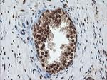 COPS5 Antibody in Immunohistochemistry (Paraffin) (IHC (P))