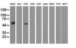 CORO1B Antibody in Western Blot (WB)