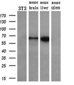 CORO1B Antibody in Western Blot (WB)