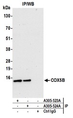 COX5B Antibody in Western Blot (WB)