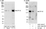 CP110 Antibody in Western Blot (WB)