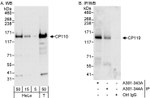 CP110 Antibody in Western Blot (WB)