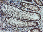 CPA2 Antibody in Immunohistochemistry (Paraffin) (IHC (P))