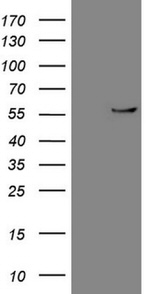 CPM Antibody in Western Blot (WB)