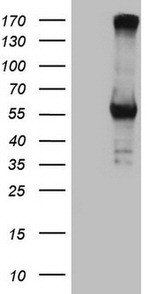 CPM Antibody in Western Blot (WB)