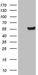 CPM Antibody in Western Blot (WB)