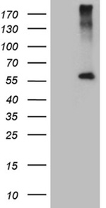 CPM Antibody in Western Blot (WB)