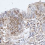 CPSF68 Antibody in Immunohistochemistry (IHC)