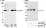 CPSF68 Antibody in Western Blot (WB)