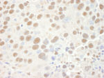 CPSF68 Antibody in Immunohistochemistry (IHC)