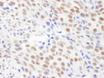 CPSF68 Antibody in Immunohistochemistry (IHC)