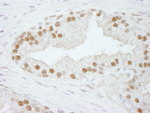 CPSF73 Antibody in Immunohistochemistry (IHC)