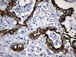 CPT1B Antibody in Immunohistochemistry (Paraffin) (IHC (P))