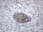 CPT1B Antibody in Immunohistochemistry (Paraffin) (IHC (P))