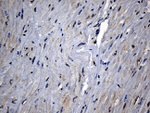 CPT1B Antibody in Immunohistochemistry (Paraffin) (IHC (P))