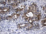 CPT1B Antibody in Immunohistochemistry (Paraffin) (IHC (P))