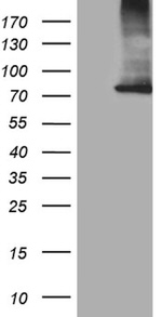 CPT1B Antibody in Western Blot (WB)