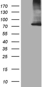 CPT1B Antibody in Western Blot (WB)