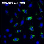 CRABP2 Antibody in Immunocytochemistry (ICC/IF)