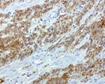 CRABP2 Antibody in Immunohistochemistry (Paraffin) (IHC (P))