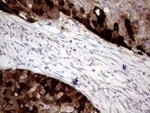 CRABP2 Antibody in Immunohistochemistry (Paraffin) (IHC (P))