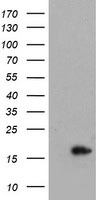 CRABP2 Antibody in Western Blot (WB)