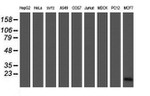 CRABP2 Antibody in Western Blot (WB)