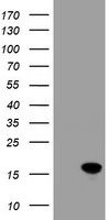 CRABP2 Antibody in Western Blot (WB)