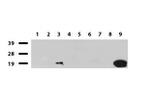 CRABP2 Antibody in Western Blot (WB)