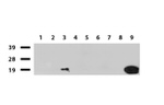 CRABP2 Antibody in Western Blot (WB)